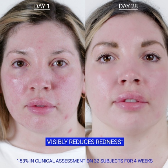 Fresh Floral Recovery Calming Face Mask 🌹 - Picture 12 of 16